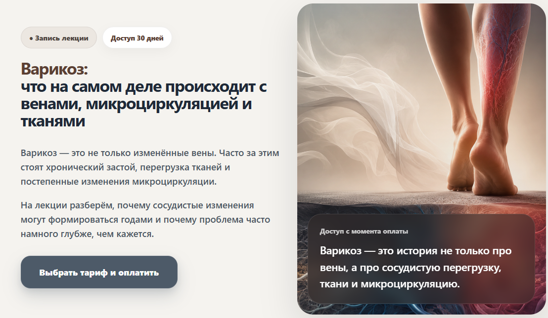 Humberto 2.0 - Елена Иванова → Варикоз: что на самом деле происходит с венами